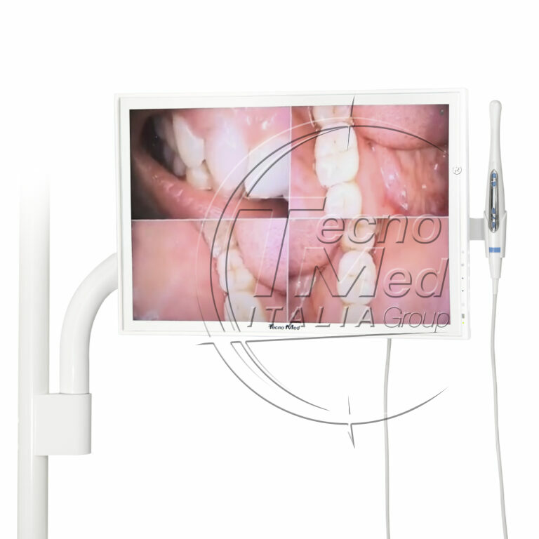 Kit telecamera intraorale DETECT + monitor + braccio palo 45 mm