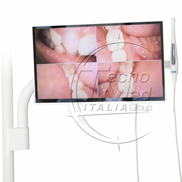 Kit telecamera intraorale DETECT + monitor + braccio palo 45 mm