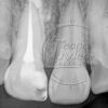 Rvg Tecnoray XP intraoral sensor, 30×20mm sensor - Image 3